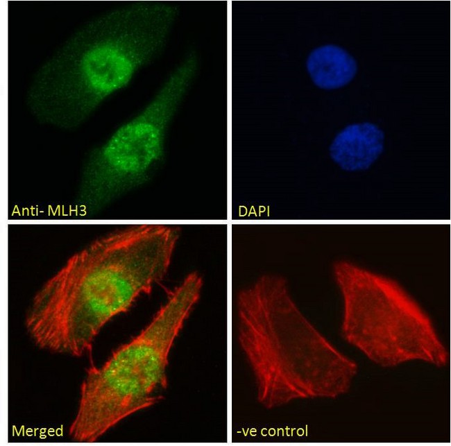 MLH3 Antibody - Goat Anti-MLH3 Antibody Immunofluorescence analysis of paraformaldehyde fixed HeLa cells, permeabilized with 0.15% Triton. Primary incubation 1hr (10ug/ml) followed by Alexa Fluor 488 secondary antibody (2ug/ml), showing nuclear staining. Actin filaments were stained with phalloidin (red) and the nuclear stain is DAPI (blue). Negative control: Unimmunized goat IgG (10ug/ml) followed by Alexa Fluor 488 secondary antibody (2ug/ml).