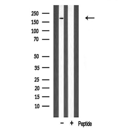 MLH3 Antibody - Western blot analysis of extracts of rat spleen using MLH3 antibody.