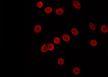 MLH3 Antibody - Staining K562 cells by IF/ICC. The samples were fixed with PFA and permeabilized in 0.1% Triton X-100, then blocked in 10% serum for 45 min at 25°C. The primary antibody was diluted at 1:200 and incubated with the sample for 1 hour at 37°C. An Alexa Fluor 594 conjugated goat anti-rabbit IgG (H+L) Ab, diluted at 1/600, was used as the secondary antibody.