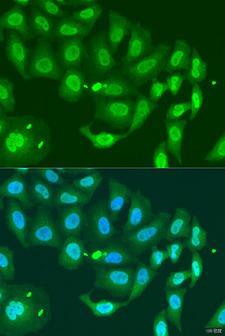MLH3 Antibody - Immunofluorescence analysis of U2OS cells using MLH3 Polyclonal Antibody at dilution of 1:100.Blue: DAPI for nuclear staining.
