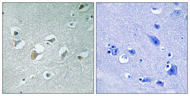 MLK1+2 Antibody - P-peptide - + Immunohistochemistry analysis of paraffin-embedded human brain tissue using MLK1/2 (Phospho-Thr312/266) antibody. MLK1/2 (Phospho-Thr312/266) antibody reacts with epitope-specific phosphopeptide and corresponding non-phosphopeptide.