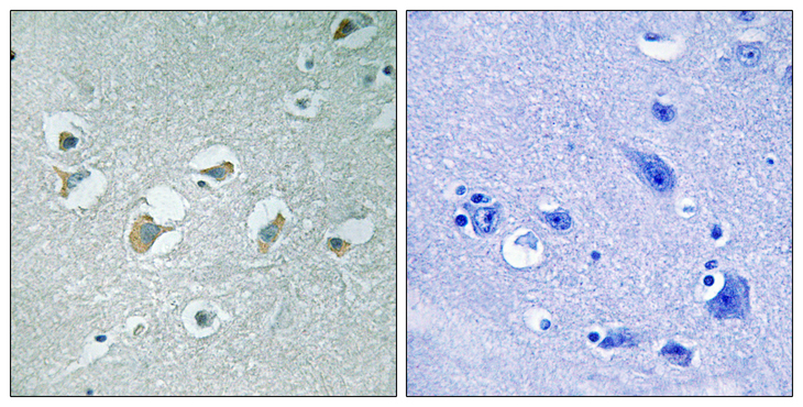 MLK1+2 Antibody - Immunohistochemistry analysis of paraffin-embedded human brain, using MLK1/2 (Phospho-Thr312/266) Antibody. The picture on the right is blocked with the phospho peptide.