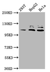MLK4 / KIAA1804 Antibody - Western Blot Positive WB detected in: 293T whole cell lysate, HepG2 whole cell lysate, Hela whole cell lysate All Lanes: MAP3K21 antibody at 3.3µg/ml Secondary Goat polyclonal to rabbit IgG at 1/50000 dilution Predicted band size: 114, 64, 53 KDa Observed band size: 114 KDa
