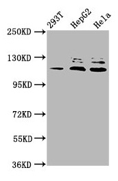 MLK4 / KIAA1804 Antibody - Western Blot Positive WB detected in: 293T whole cell lysate, HepG2 whole cell lysate, Hela whole cell lysate All lanes: MAP3K21 antibody at 3.3µg/ml Secondary Goat polyclonal to rabbit IgG at 1/50000 dilution Predicted band size: 114, 64, 53 kDa Observed band size: 114 kDa