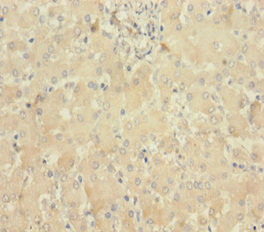 MLKL Antibody - Immunohistochemistry of paraffin-embedded human liver tissue using MLKL Antibody at dilution of 1:100