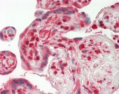 MLKL Antibody - Human Placenta: Formalin-Fixed, Paraffin-Embedded (FFPE).  This image was taken for the unconjugated form of this product. Other forms have not been tested.