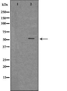 MLKL Antibody - Western blot analysis of extracts of THP1 using MLKL antibody. The lane on the left is treated with the antigen-specific peptide.