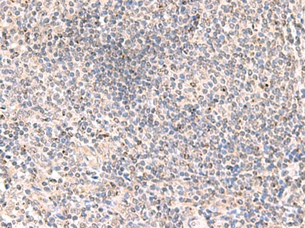 MLKL Antibody - Immunohistochemistry of paraffin-embedded Human tonsil tissue  using MLKL Polyclonal Antibody at dilution of 1:85(×200)