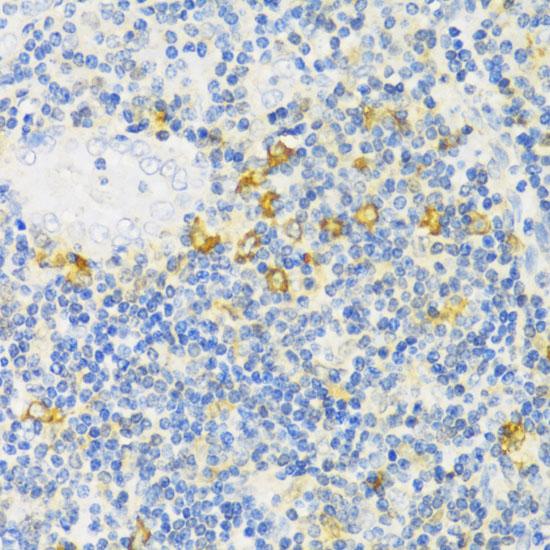 MLKL Antibody - Immunohistochemistry of paraffin-embedded Human tonsil using MLKL Polyclonal Antibody at dilution of 1:100 (40x lens).