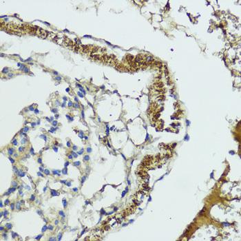 MLKL Antibody - Immunohistochemistry of paraffin-embedded Mouse lung using MLKL Polyclonal Antibody at dilution of 1:200 (40x lens).