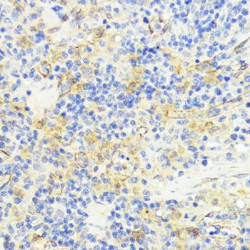 MLKL Antibody - Immunohistochemistry of paraffin-embedded Rat spleen using MLKL Polyclonal Antibody at dilution of 1:200 (40x lens).