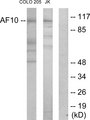 MLLT10 Antibody - Western blot analysis of lysates from COLO205 and Jurkat cells, using AF10 Antibody. The lane on the right is blocked with the synthesized peptide.