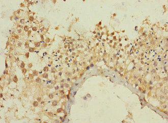 MLLT10 Antibody - Immunohistochemistry of paraffin-embedded human testis tissue using MLLT10 Antibody at dilution of 1:100