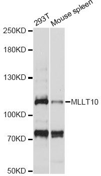 MLLT10 Antibody - Western blot analysis of extracts of various cell lines, using MLLT10 antibody at 1:1000 dilution. The secondary antibody used was an HRP Goat Anti-Rabbit IgG (H+L) at 1:10000 dilution. Lysates were loaded 25ug per lane and 3% nonfat dry milk in TBST was used for blocking. An ECL Kit was used for detection and the exposure time was 5s.