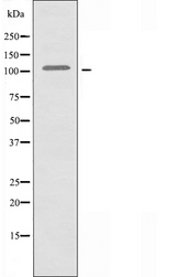MLLT10 Antibody - Western blot analysis of extracts of COLO205 cells using AF10 antibody.