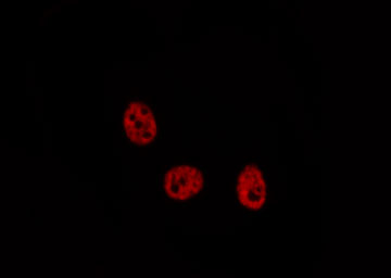 MLLT10 Antibody - Staining COLO205 cells by IF/ICC. The samples were fixed with PFA and permeabilized in 0.1% Triton X-100, then blocked in 10% serum for 45 min at 25°C. The primary antibody was diluted at 1:200 and incubated with the sample for 1 hour at 37°C. An Alexa Fluor 594 conjugated goat anti-rabbit IgG (H+L) antibody, diluted at 1/600, was used as secondary antibody.
