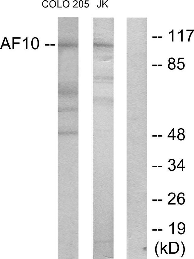 MLLT10 Antibody - Western blot analysis of extracts from COLO205 cells and Jurkat cells, using AF10 antibody.