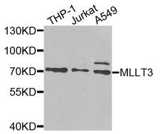 MLLT3 / AF9 Antibody - Western blot analysis of extracts of various cells.