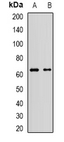 MLLT3 / AF9 Antibody - Western blot analysis of AF9 expression in Jurkat (A); A549 (B) whole cell lysates.