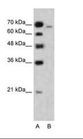 MLLT4 / Afadin Antibody - A: Marker, HepG2 Cell Lysate.  This image was taken for the unconjugated form of this product. Other forms have not been tested.