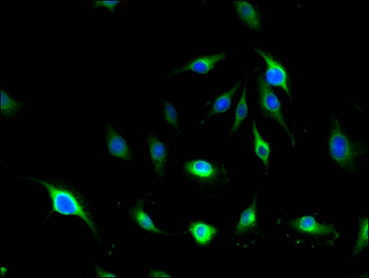 MLLT4 / Afadin Antibody - Immunofluorescent analysis of U251 cells using MLLT4 Antibody at a dilution of 1:100 and Alexa Fluor 488-congugated AffiniPure Goat Anti-Rabbit IgG(H+L)