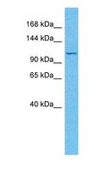 MLLT6 Antibody - Western blot of AF17 Antibody with human PANC1 Whole Cell lysate.  This image was taken for the unconjugated form of this product. Other forms have not been tested.