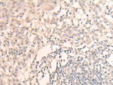 MLLT6 Antibody - Immunohistochemistry of paraffin-embedded Human tonsil tissue  using MLLT6 Polyclonal Antibody at dilution of 1:40(×200)