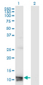 MLN / Motilin Antibody - Western Blot analysis of MLN expression in transfected 293T cell line by MLN monoclonal antibody (M07), clone 4E12.Lane 1: MLN transfected lysate (Predicted MW: 12.9 KDa).Lane 2: Non-transfected lysate.