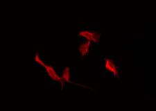 MLNR/GPR38/Motilin Receptor Antibody - Staining HeLa cells by IF/ICC. The samples were fixed with PFA and permeabilized in 0.1% Triton X-100, then blocked in 10% serum for 45 min at 25°C. The primary antibody was diluted at 1:200 and incubated with the sample for 1 hour at 37°C. An Alexa Fluor 594 conjugated goat anti-rabbit IgG (H+L) Ab, diluted at 1/600, was used as the secondary antibody.