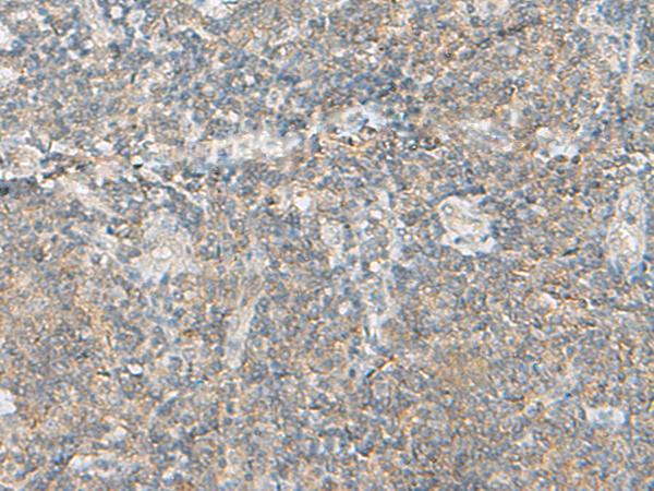 MLNR/GPR38/Motilin Receptor Antibody - Immunohistochemistry of paraffin-embedded Human tonsil tissue  using MLNR Polyclonal Antibody at dilution of 1:35(×200)