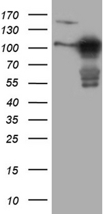 MLPH / Melanophilin Antibody - HEK293T cells were transfected with the pCMV6-ENTRY control. (Left lane) or pCMV6-ENTRY MLPH. (Right lane) cDNA for 48 hrs and lysed. Equivalent amounts of cell lysates. (5 ug per lane) were separated by SDS-PAGE and immunoblotted with anti-MLPH. (1:2000)