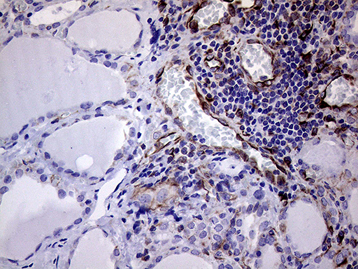 MLPH / Melanophilin Antibody - Immunohistochemical staining of paraffin-embedded Human thyroid tissue within the normal limits using anti-MLPH mouse monoclonal antibody. (Heat-induced epitope retrieval by 1mM EDTA in 10mM Tris buffer. (pH8.5) at 120°C for 3 min. (1:500)