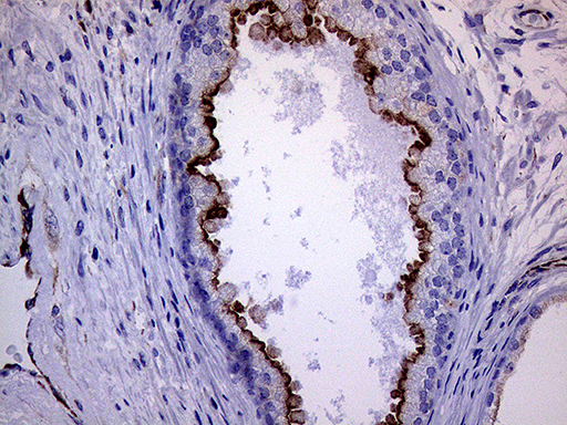 MLPH / Melanophilin Antibody - Immunohistochemical staining of paraffin-embedded Human prostate tissue within the normal limits using anti-MLPH mouse monoclonal antibody. (Heat-induced epitope retrieval by 1mM EDTA in 10mM Tris buffer. (pH8.5) at 120°C for 3 min. (1:500)