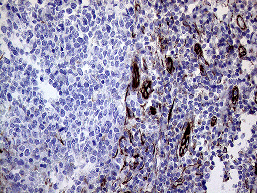 MLPH / Melanophilin Antibody - Immunohistochemical staining of paraffin-embedded Human tonsil within the normal limits using anti-MLPH mouse monoclonal antibody. (Heat-induced epitope retrieval by 1mM EDTA in 10mM Tris buffer. (pH8.5) at 120°C for 3 min. (1:500)