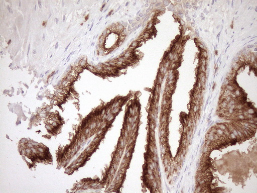 MLPH / Melanophilin Antibody - Immunohistochemical staining of paraffin-embedded Human prostate tissue within the normal limits using anti-MLPH mouse monoclonal antibody. (Heat-induced epitope retrieval by 1mM EDTA in 10mM Tris buffer. (pH8.5) at 120°C for 3 min. (1:150)