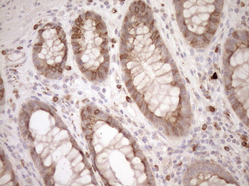 MLPH / Melanophilin Antibody - Immunohistochemical staining of paraffin-embedded Human colon tissue within the normal limits using anti-MLPH mouse monoclonal antibody. (Heat-induced epitope retrieval by 1mM EDTA in 10mM Tris buffer. (pH8.5) at 120°C for 3 min. (1:150)