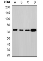MLPH / Melanophilin Antibody - Western blot analysis of Melanophilin expression in MCF7 (A); HT29 (B); mouse lung (C); rat lung (D) whole cell lysates.