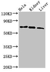 MLPH / Melanophilin Antibody - Western Blot Positive WB detected in: Hela whole cell lysate, Mouse kidney tissue, Mouse liver tissue All lanes: MLPH antibody at 3µg/ml Secondary Goat polyclonal to rabbit IgG at 1/50000 dilution Predicted band size: 66, 63, 53, 61, 51 kDa Observed band size: 66 kDa
