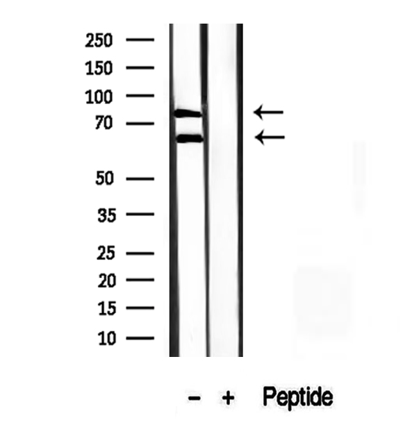 MLPH / Melanophilin Antibody - Western blot analysis of extracts of A375 cells using Melanophilin antibody.