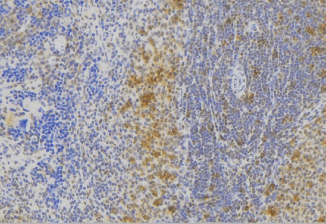 MLPH / Melanophilin Antibody - 1:100 staining human lymph node tissue by IHC-P. The sample was formaldehyde fixed and a heat mediated antigen retrieval step in citrate buffer was performed. The sample was then blocked and incubated with the antibody for 1.5 hours at 22°C. An HRP conjugated goat anti-rabbit antibody was used as the secondary.