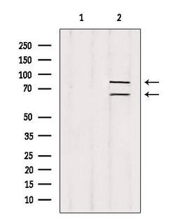 MLPH / Melanophilin Antibody - Western blot analysis of extracts of rat spleen using Melanophilin antibody. Lane 1 was treated with the blocking peptide.
