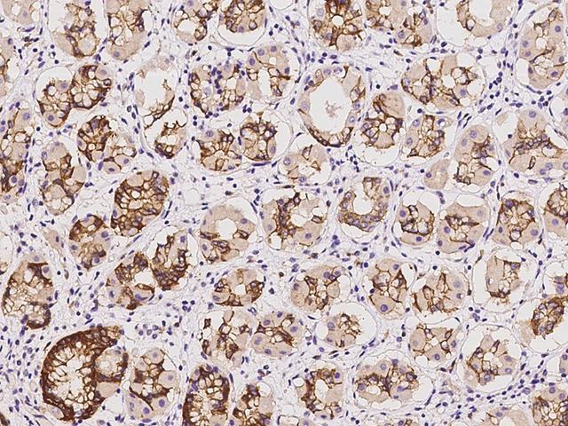 MLPH / Melanophilin Antibody - Immunochemical staining of human MLPH in human stomach with rabbit polyclonal antibody at 1:100 dilution, formalin-fixed paraffin embedded sections.