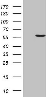 MLR2 / LCOR Antibody - HEK293T cells were transfected with the pCMV6-ENTRY control (Left lane) or pCMV6-ENTRY LCOR (Right lane) cDNA for 48 hrs and lysed. Equivalent amounts of cell lysates (5 ug per lane) were separated by SDS-PAGE and immunoblotted with anti-LCOR (1:2000).