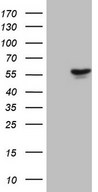MLR2 / LCOR Antibody - HEK293T cells were transfected with the pCMV6-ENTRY control (Left lane) or pCMV6-ENTRY LCOR (Right lane) cDNA for 48 hrs and lysed. Equivalent amounts of cell lysates (5 ug per lane) were separated by SDS-PAGE and immunoblotted with anti-LCOR (1:2000).