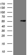 MLR2 / LCOR Antibody - HEK293T cells were transfected with the pCMV6-ENTRY control. (Left lane) or pCMV6-ENTRY LCOR. (Right lane) cDNA for 48 hrs and lysed. Equivalent amounts of cell lysates. (5 ug per lane) were separated by SDS-PAGE and immunoblotted with anti-LCOR. (1:2000)