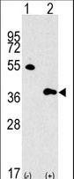 MLST8 / GBL Antibody - Western blot of GBL Antibody polyclonal antibody(arrow). 293 cell lysates (2 ug/lane) either nontransfected (Lane 1) or transiently transfected with the GBL gene (Lane 2) (Origene Technologies).