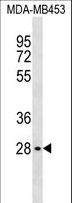 MLST8 / GBL Antibody - GBL Antibody western blot of MDA-MB453 cell line lysates (35 ug/lane). The GBL antibody detected the GBL protein (arrow).