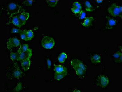 MLST8 / GBL Antibody - Immunofluorescent analysis of MCF-7 cells at a dilution of 1:100 and Alexa Fluor 488-congugated AffiniPure Goat Anti-Rabbit IgG(H+L)