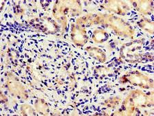 MLST8 / GBL Antibody - Immunohistochemistry image of paraffin-embedded human kidney tissue at a dilution of 1:100