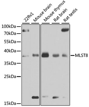 MLST8 / GBL Antibody - Western blot analysis of extracts of various cell lines, using MLST8 antibody at 1:1000 dilution. The secondary antibody used was an HRP Goat Anti-Rabbit IgG (H+L) at 1:10000 dilution. Lysates were loaded 25ug per lane and 3% nonfat dry milk in TBST was used for blocking. An ECL Kit was used for detection and the exposure time was 5s.